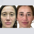 Full face (armonizacion)