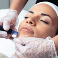 Microneedling con Exosomas Europeos