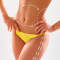 Lipoescultura sin cirugia