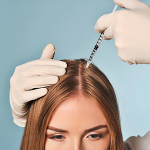 Mesoterapia capilar